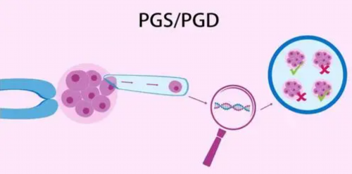 深圳代怀哪里有,三代试管婴儿深圳(通知哪家医院好)